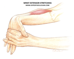 tennis elbow